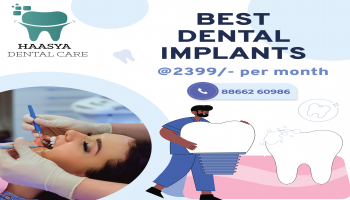 Best Dental Implants at Affordable Prices