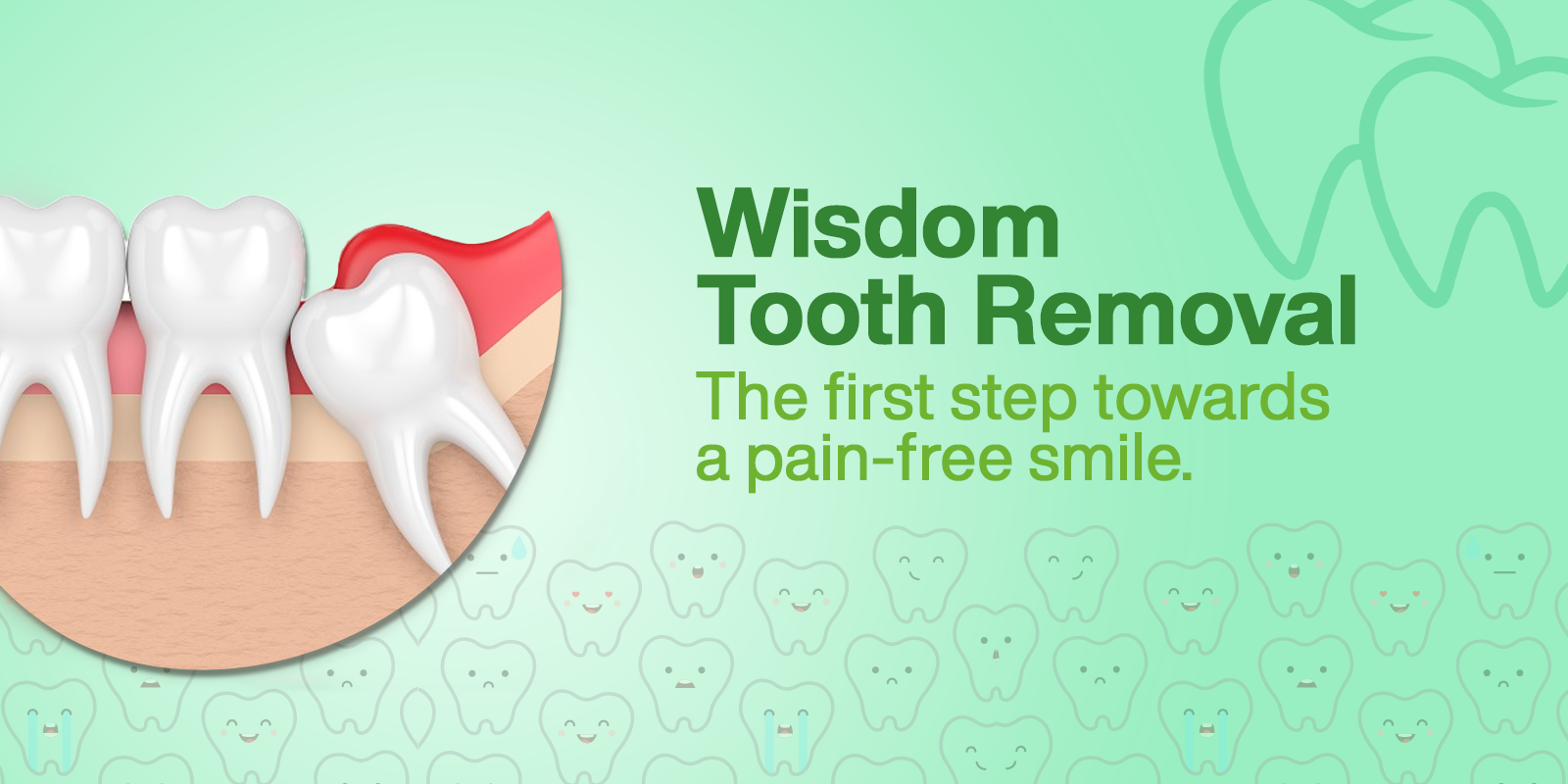 Wisdom Tooth Removal
