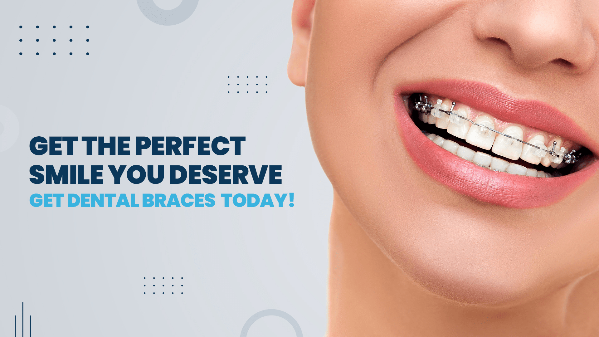 Dental Braces or Teeth Braces